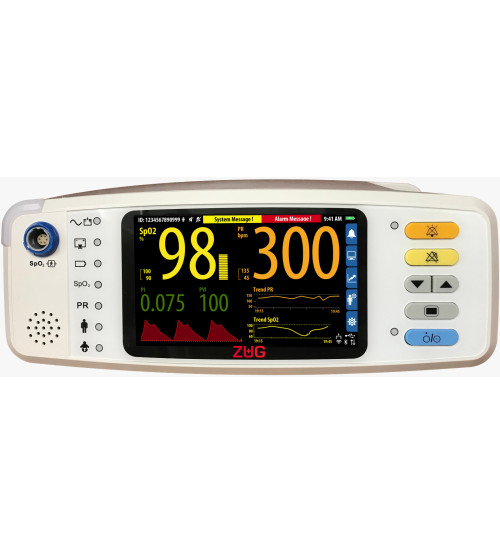MS 1000 Vital Signs Monitor | Typ SpotLife® OX